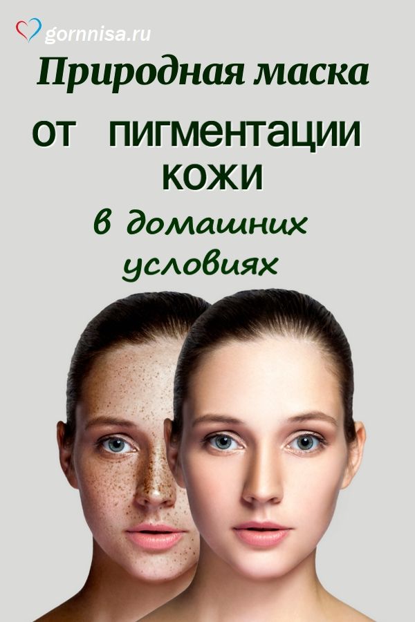 Природная маска от пигментации кожи https://gornnisa.ru/