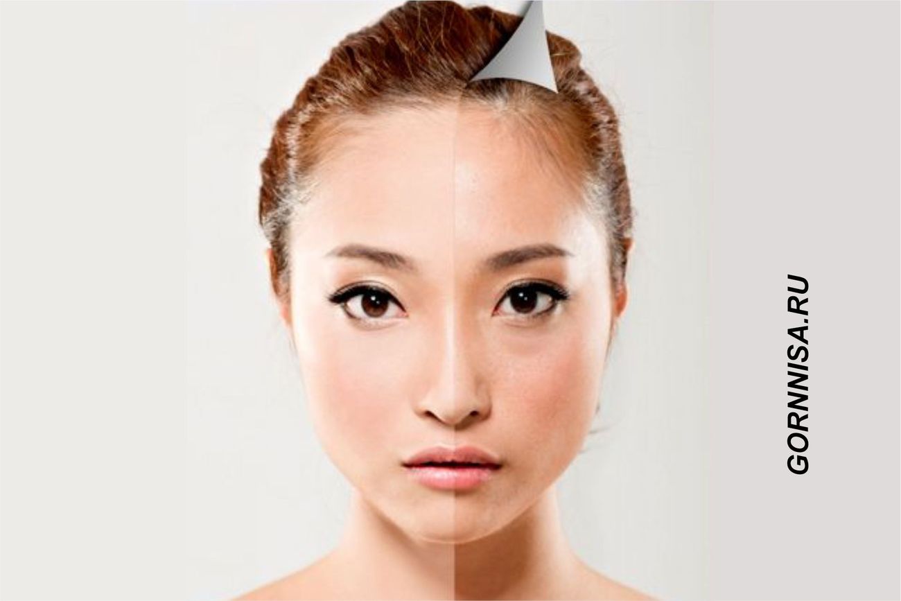 Азиатский секрет гладкой кожи лица – Эффективные способы удаления косметических шрамов в домашних условиях
